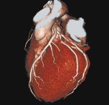 Cross-training physicians would close the gap between reading complex cardiac CT exams and a standard chest CT exam. Photo courtesy of Toshiba America Medical Systems.