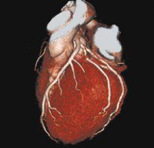 Cross-training physicians would close the gap between reading complex cardiac CT exams and a standard chest CT exam. Photo courtesy of Toshiba America Medical Systems.