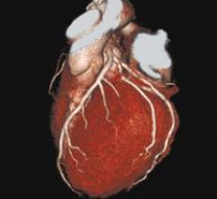 Cross-training physicians would close the gap between reading complex cardiac CT exams and a standard chest CT exam. Photo courtesy of Toshiba America Medical Systems.